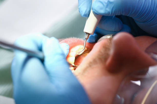 Best Emergency Cosmetic Dentistry in Atkinson, IL
