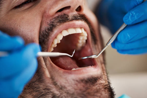 Best Emergency Dental Care for Abscessed Tooth in Atkinson, IL
